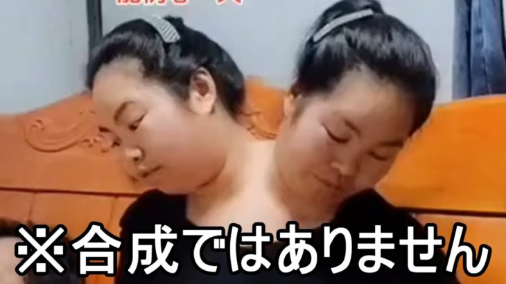 彼女達は結合してうまれてきました。彼女たちは２人で一つの存在です